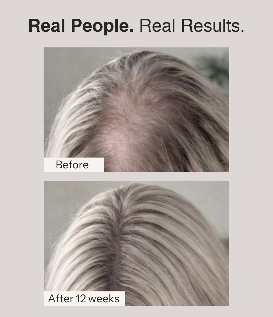 Hair Formula
